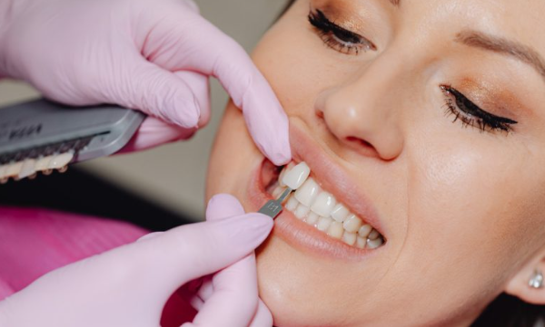 Why Preventive Care Protects The Investment Of Veneers, Crowns, And Whitening